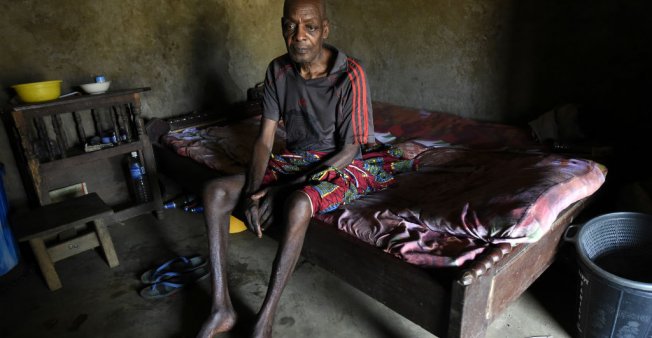 © Pius Utomi Ekpei, AFP | Cameroonian refugee Ben Ojometa, 75, sits to recuperate from injuries sustained fleeing Cameroon’s military in Agborkim town, Etung district of Cross Rivers State, southeast Nigeria, on February 2, 2018.