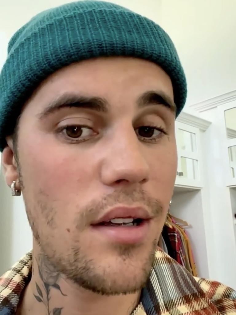 Justin Bieber's face is partially paralysed due to a rare illness.