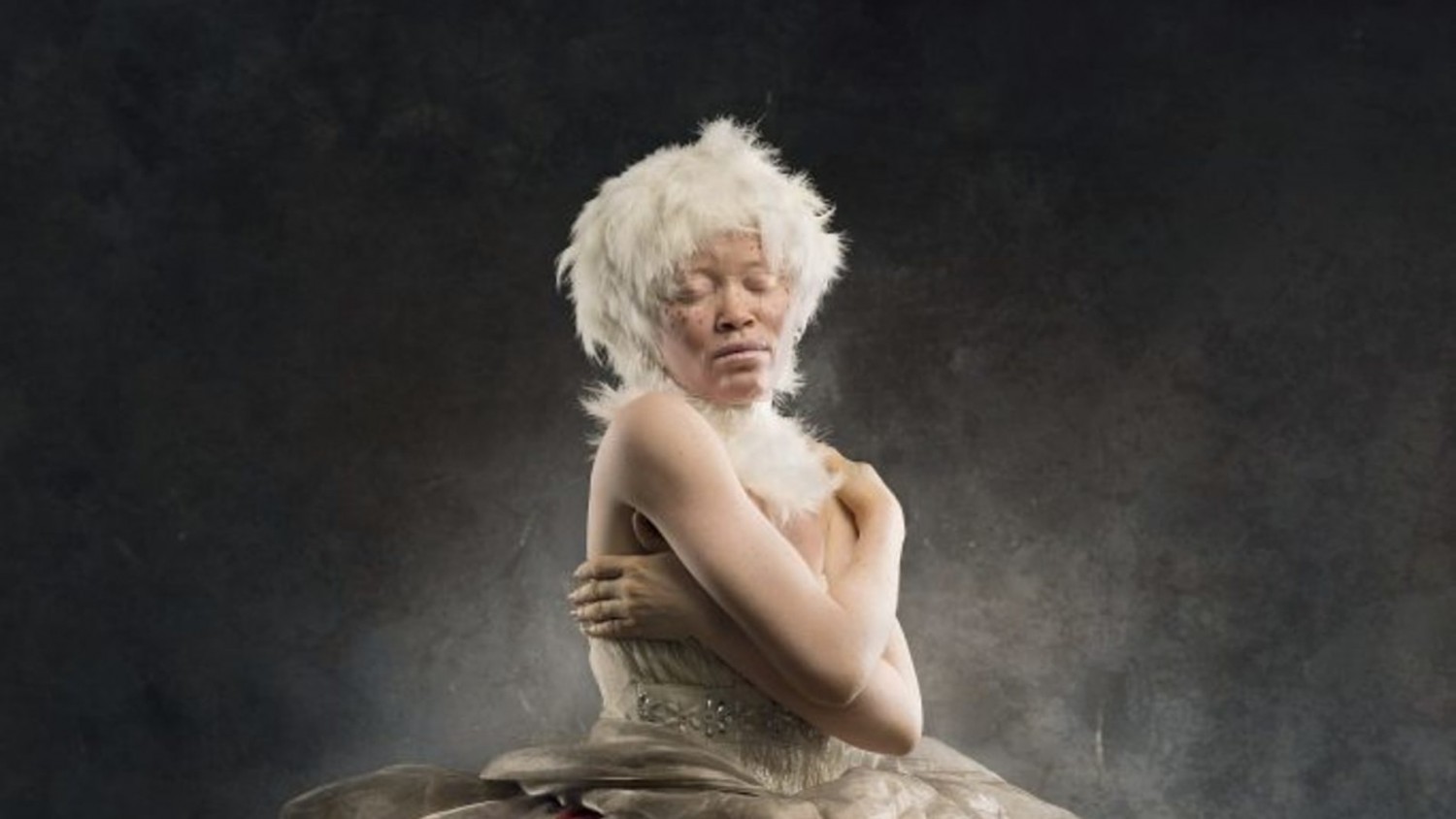Yetunde Ayeni-Babaeko captures the beauty of people with albinism